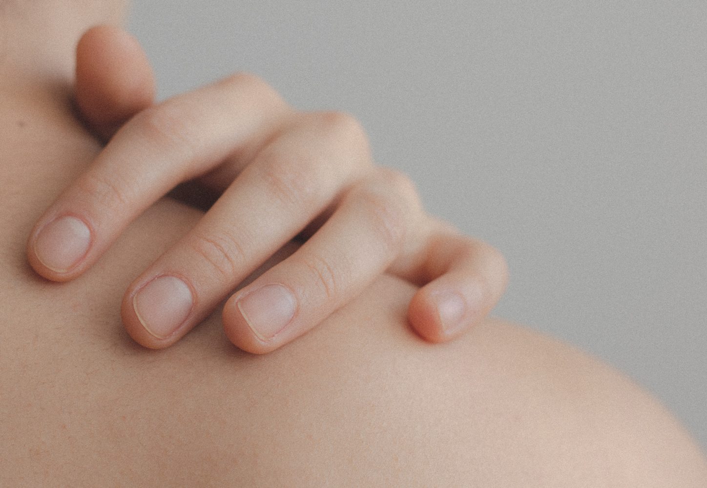 Psoriasis and Inflammation Treatment in Marbella