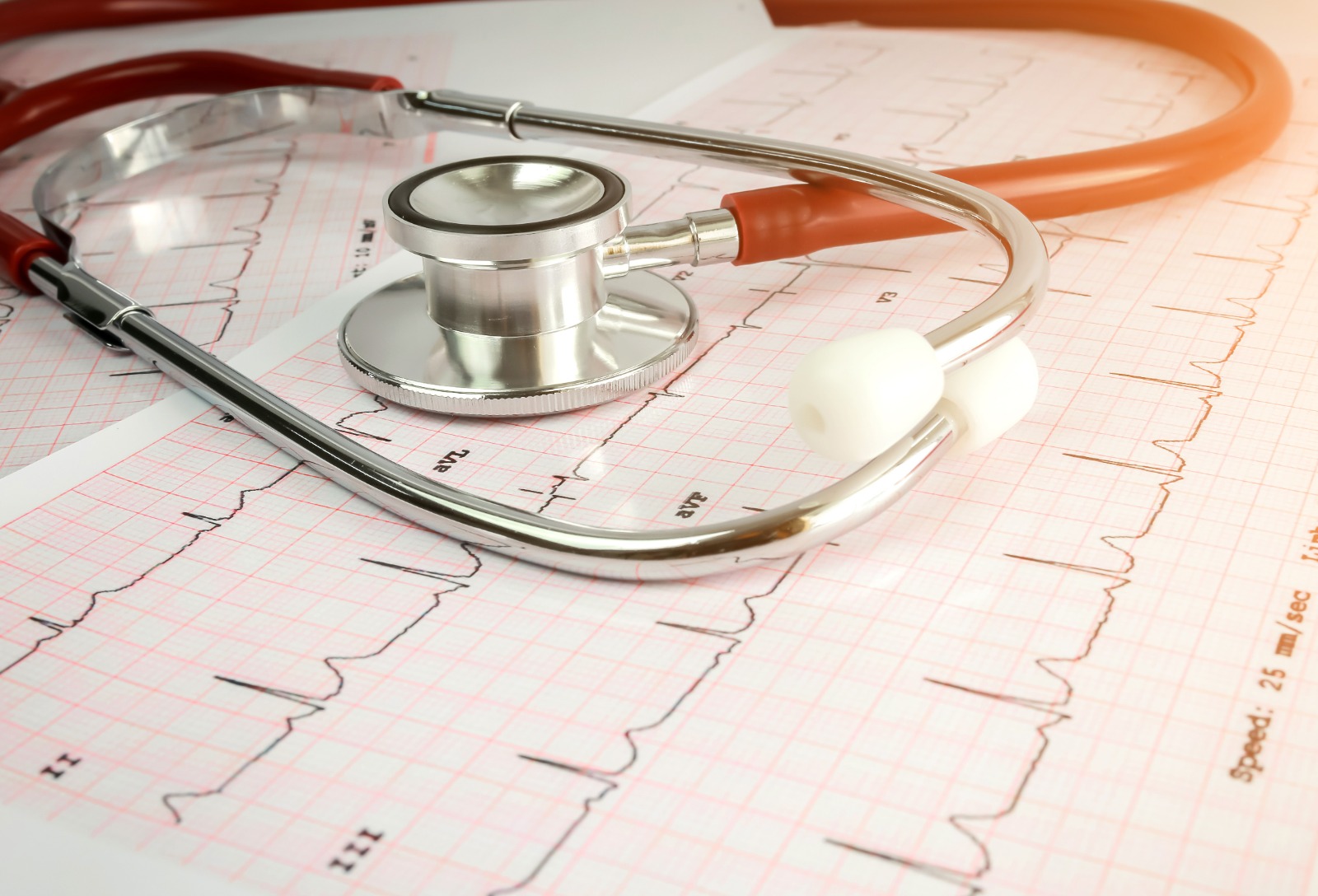 Electrophysiology Studies in Costa del Sol
