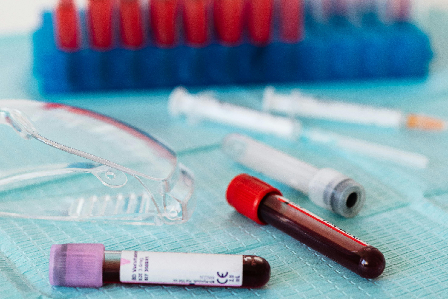 Alzheimer’s Progession Diagnosis in Marbella